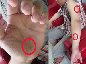 Pháp luật - Tố cáo hiếp dâm, bị đâm đến gãy cán dao?