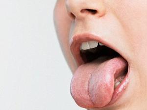 Sức khỏe đời sống - Bắt bệnh qua thay đổi của lưỡi