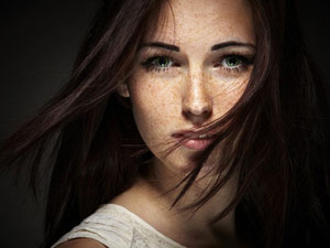 Chữa “ác mộng" nám sau sinh không khó