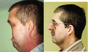 Phi thường - kỳ quặc - Kỳ lạ người đàn ông "không có mặt"