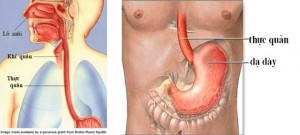 Sức khỏe đời sống - Trào ngược dạ dày thực quản dễ dẫn đến ung thư