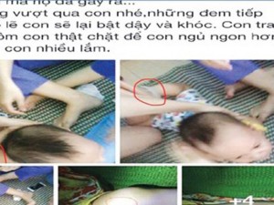 Tin tức trong ngày - Nhật ký đẫm nước mắt của mẹ bé 15 tháng tuổi bị bạo hành