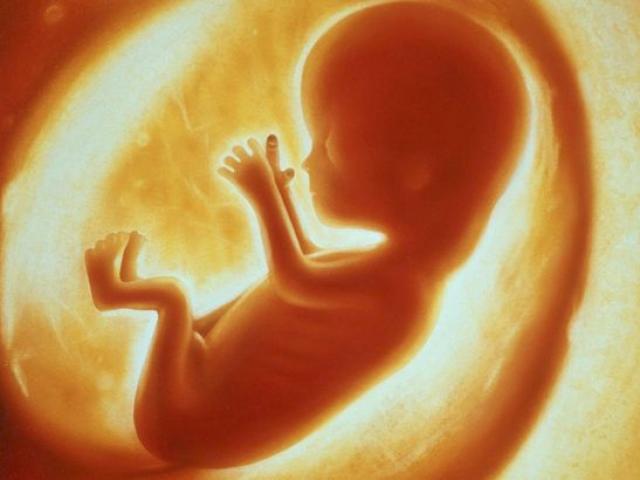 Sức khỏe đời sống - Hi hữu: Phát hiện thai chết lưu trong bụng cậu bé 4 tuổi