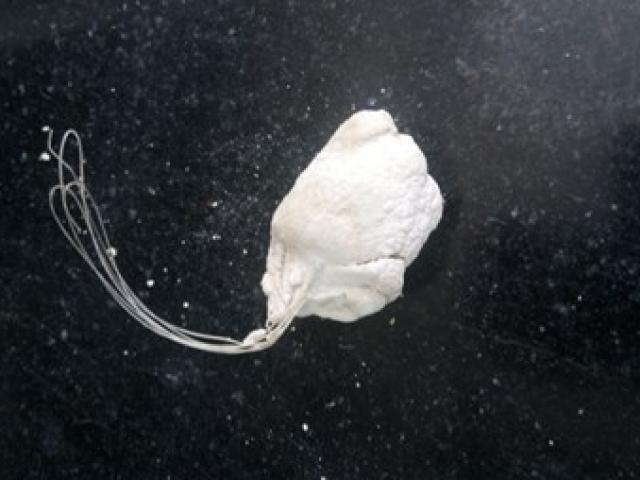 Sức khỏe đời sống - Phát hiện cước câu cá trong… niệu đạo thiếu niên