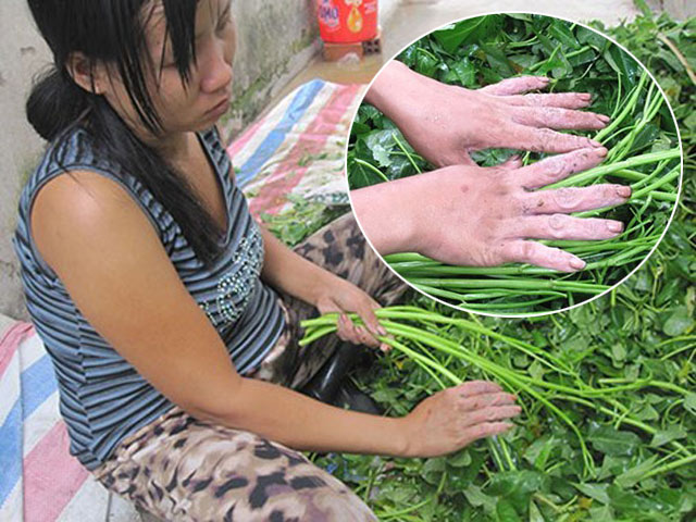 Tin tức Việt Nam - Đôi bàn tay "biến dạng" vì nhặt rau muống thuê