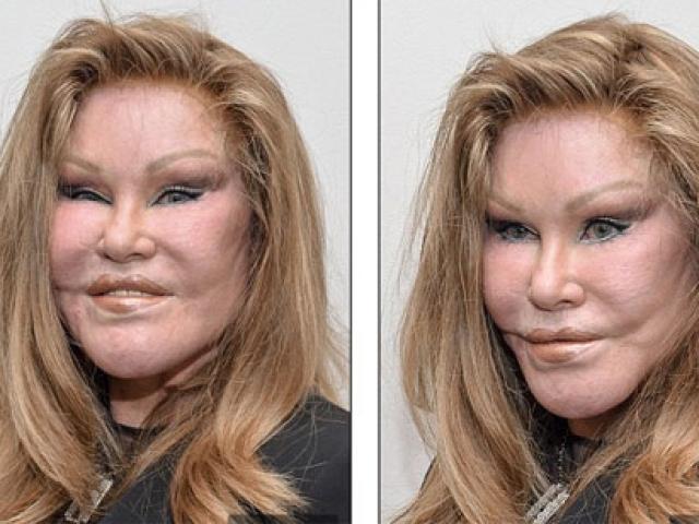 Thẩm mỹ viện - "Thảm họa thẩm mỹ" tái xuất bên người tình bảnh trai