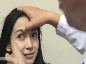 Phim - Angelababy tới bệnh viện giám định &quot;không dao kéo&quot;