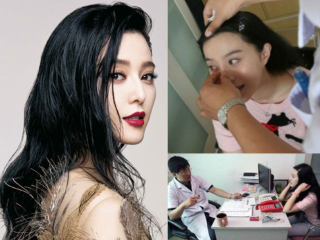 Làm đẹp - Mỹ nhân Hoa nô nức chứng minh chưa từng "dao kéo"