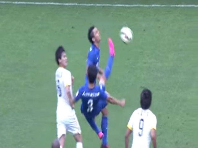 Bóng đá - Bị thương nặng vì bị đồng đội "ngả bàn đèn" trúng mặt