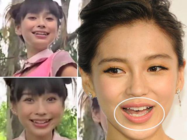 Ngôi sao điện ảnh - Fan "ngã ngửa" với ảnh cũ năm 15 tuổi của Angelababy