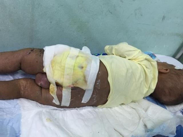 Sức khỏe đời sống - Mẹ tự chữa bệnh cho con bằng lá cây khiến bé nguy kịch