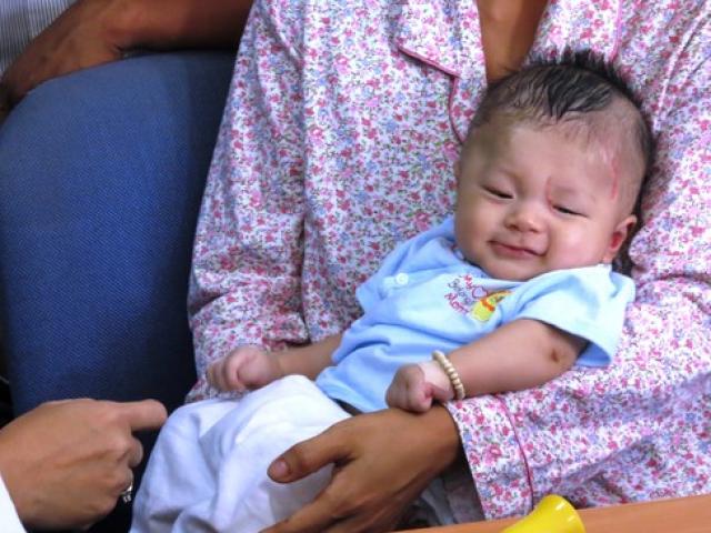 Sức khỏe đời sống - Gương mặt thiên thần của bé bị đâm xuyên não ngày tái khám