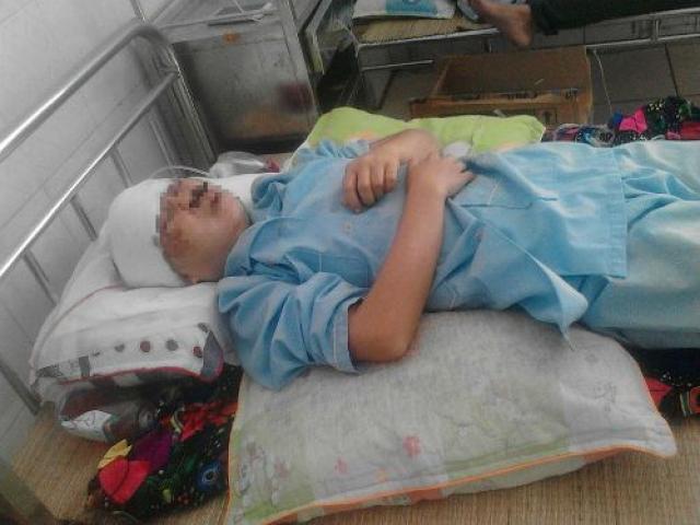 Pháp luật - Lời kể cô giáo mầm non bị "giết hụt" trong vườn mía