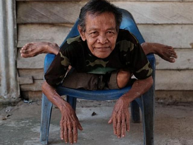 Phi thường - kỳ quặc - "Người cao su" có khả năng uống dẻo như rắn