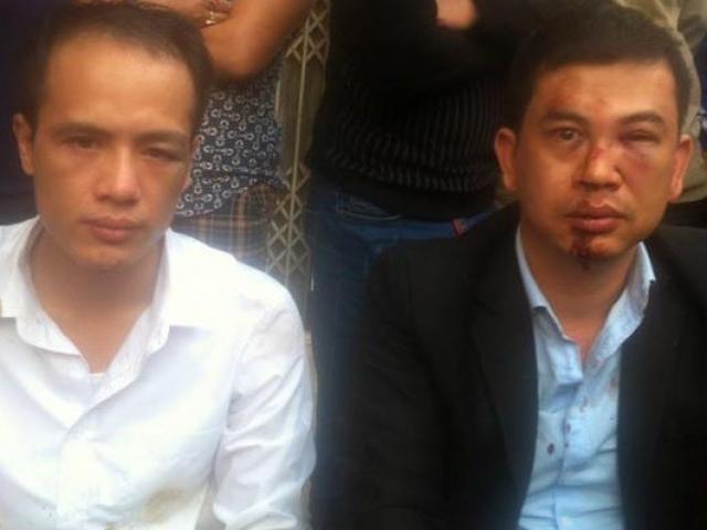 Pháp luật - Đề nghị khởi tố vụ 2 luật sư bị hành hung, cướp tài sản