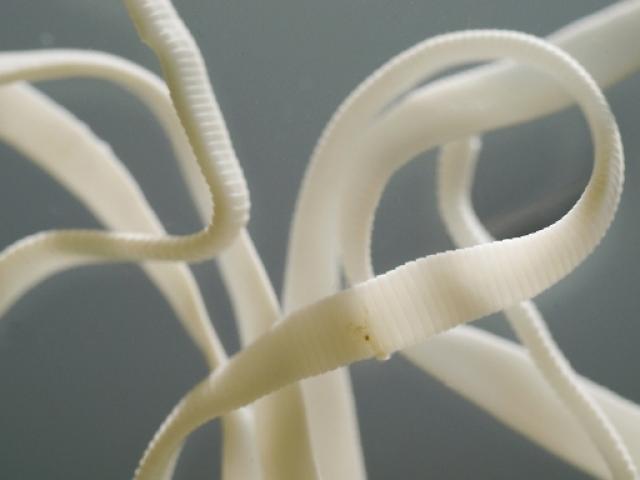 Chuyện lạ - Phát hoảng với giảm cân bằng cách... nuốt giun sán