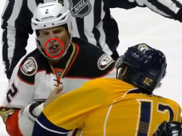 Clip Đặc Sắc - Đấm đối thủ rơi răng trong trận đấu khúc côn cầu