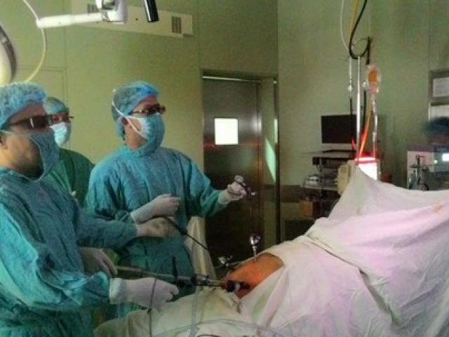 Sức khỏe đời sống - Lần đầu tiên mổ nội soi dạ dày bằng hình ảnh 3D