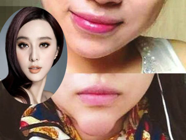 Làm đẹp - Suýt mất cằm vì tự "dao kéo" để giống Phạm Băng Băng