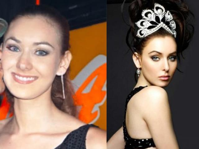 Thẩm mỹ viện - 9 "sắc đẹp nhân tạo" đăng quang Hoa hậu Hoàn vũ