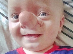Phi thường - kỳ quặc - Cậu bé có mũi dài như nhân vật hoạt hình Pinocchio
