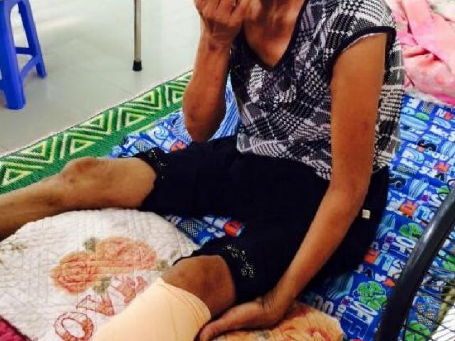 Cảnh báo chứng bệnh đơn giản nhưng có thể mất chân