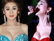 Đời sống Showbiz - Lâm Chí Khanh gánh hậu quả vì độn ngực nhiều silicon