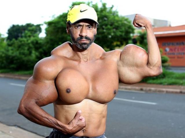 Phi thường - kỳ quặc - Người đàn ông có vòng bắp tay khổng lồ cực dị