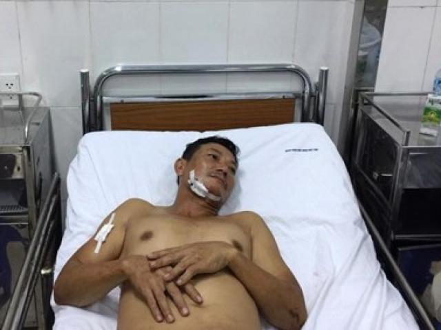 Pháp luật - Côn đồ ngáo đá đâm chạm phổi hàng xóm