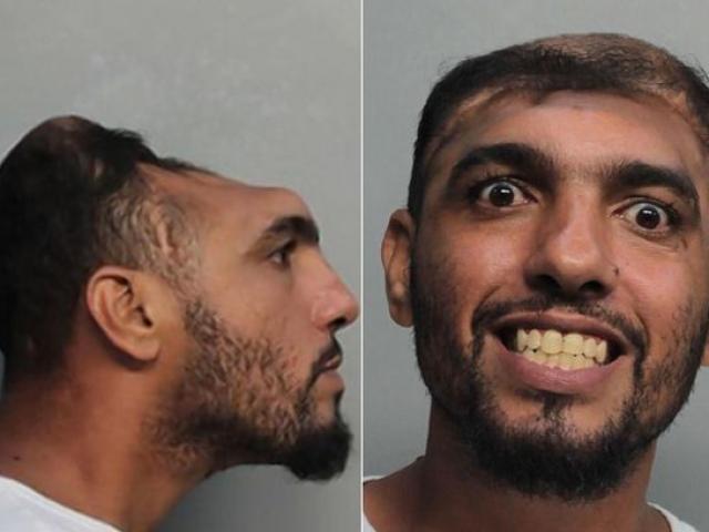 Phi thường - kỳ quặc - Mỹ: Giật mình với tên tội phạm chỉ có nửa đầu