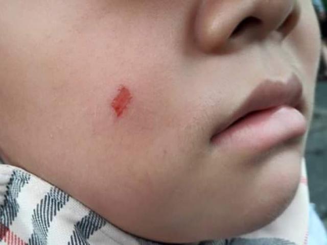 Giáo dục - du học - Cô giáo làm xước má học sinh bị phạt 5 triệu đồng