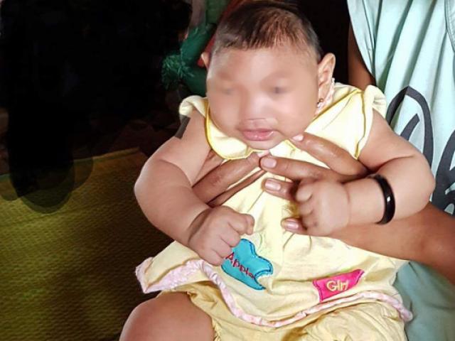 2 bé mắc chứng đầu nhỏ ở Đắk Lắk không phải do Zika
