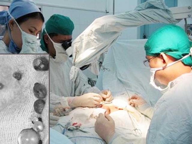 Sức khỏe đời sống - Trào lưu bơm to "cậu nhỏ"