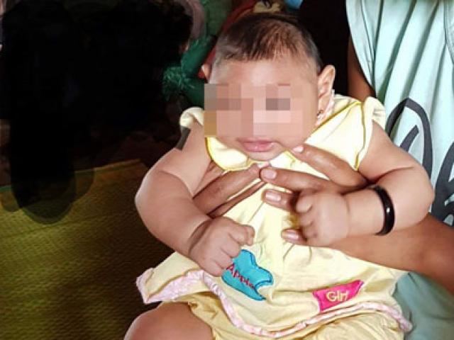 Bé gái 4 tháng tuổi ở Đắk Lắc bị dị tật do virus Zika