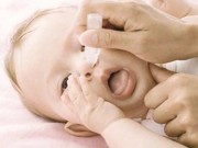 Teo mũi vì nghiện thuốc nhỏ mũi