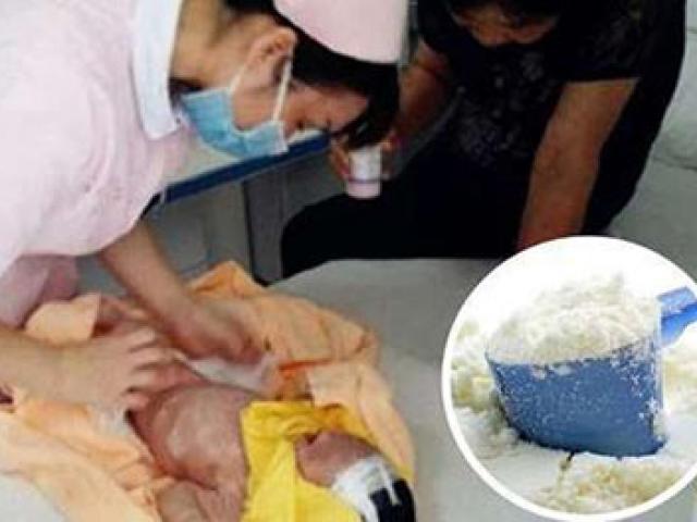 Sức khỏe đời sống - Bé sơ sinh suýt tử vong vì thói quen pha sữa sai lầm của cha mẹ