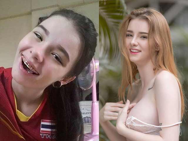 Thẩm mỹ viện - "Vỡ mộng" vì ảnh cũ của mỹ nữ Thái đang gây sốt