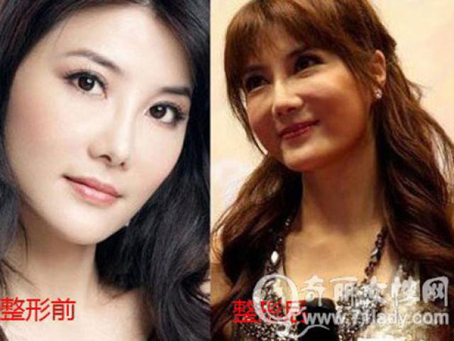 Đời sống Showbiz - Khó nhận ra "nữ thần Kung Fu" vì gương mặt biến dạng