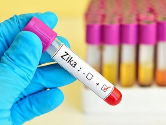 TP.HCM: Đã có 29 ca nhiễm Zika