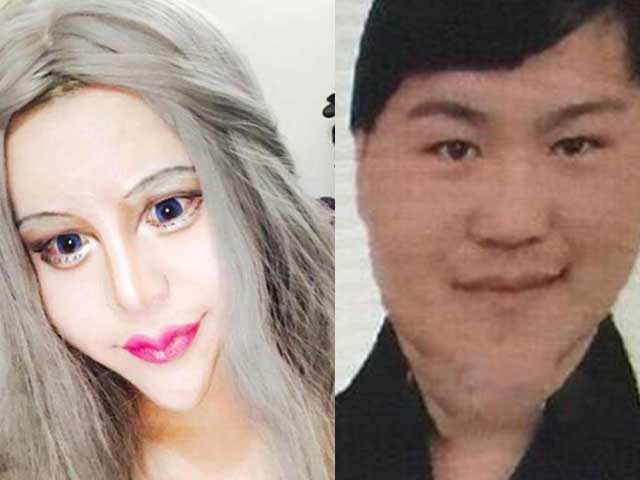 Thẩm mỹ viện - Ngất xỉu vì "xà tinh" tự nhận mình xinh nhất Trung Quốc