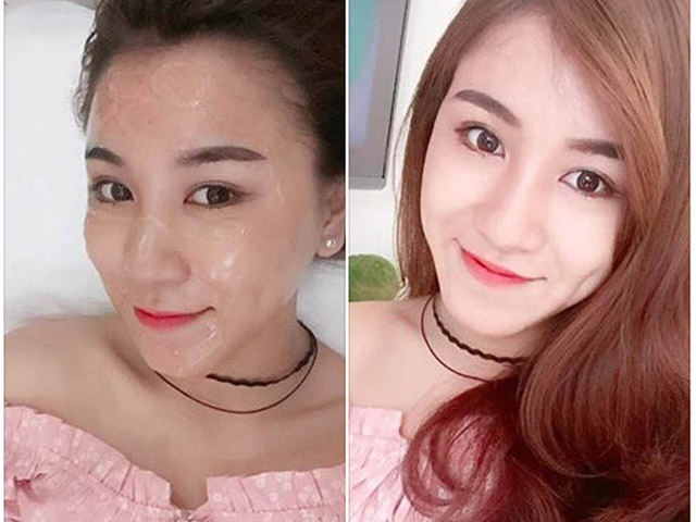 Bí quyết làm đẹp - Tín đồ làm đẹp phát sốt với trao lưu thải độc da Detox Laser