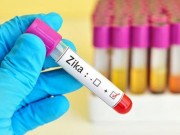 Sức khỏe đời sống - TP.HCM: Đã có 29 ca nhiễm Zika