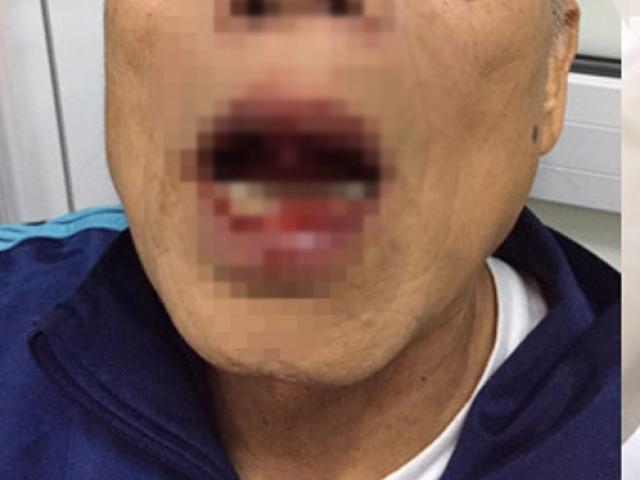 Pháp luật - Vụ tiến sĩ bị đánh: Chủ tịch HN đề nghị xử lý nghiêm