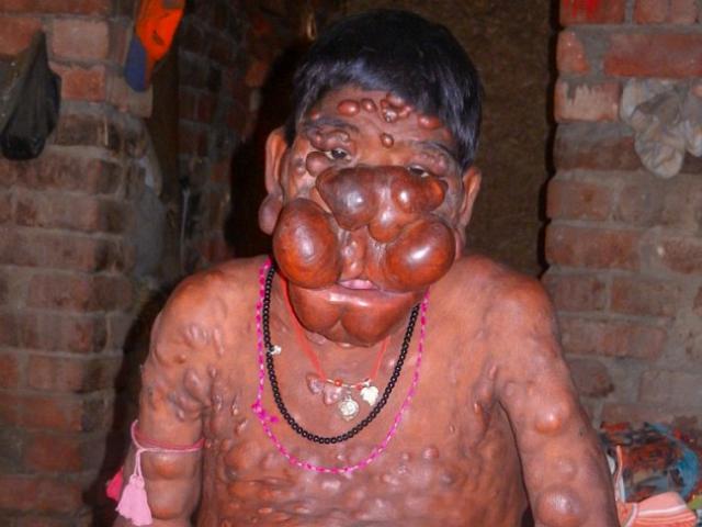 Phi thường - kỳ quặc - Cậu bé có khuôn mặt "ác quỷ" ở Ấn Độ