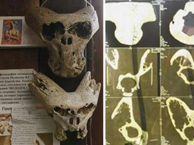 Thế giới - Phát xít Đức từng giữ 2 đầu lâu người ngoài hành tinh?