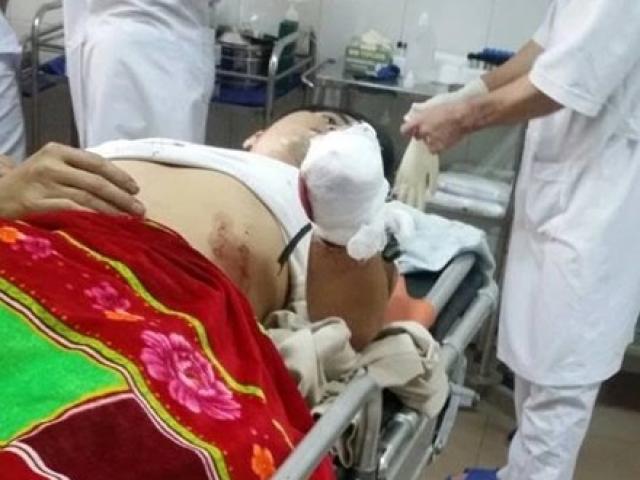 Tin tức trong ngày - Bàng hoàng thấy con tự chặt đứt cánh tay trong nhà tắm