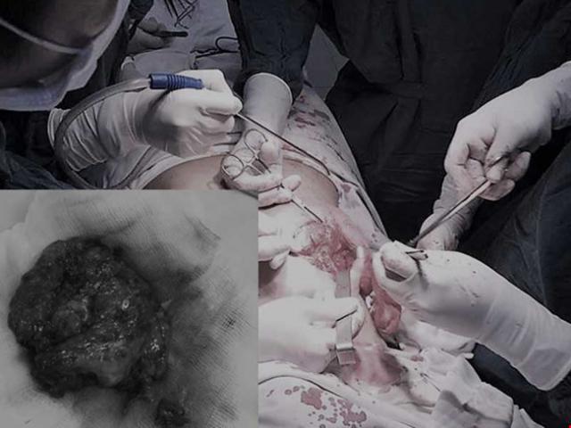 Thẩm mỹ viện - Phẫu thuật thẩm mỹ dỏm tung hoành làng quê