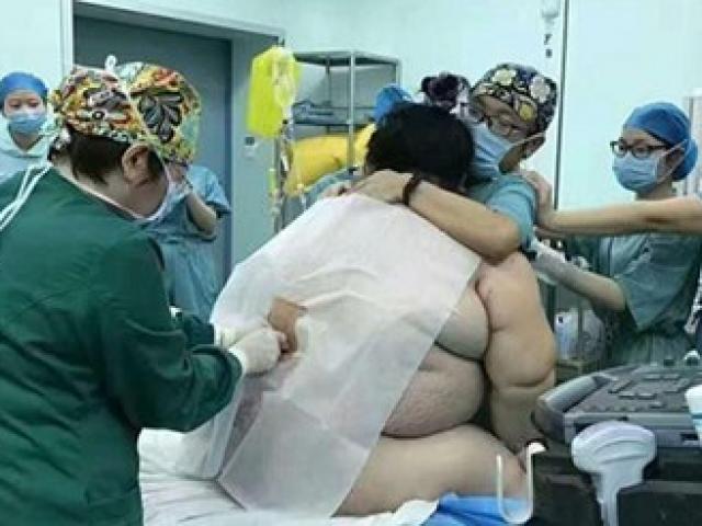 Bạn trẻ - Cuộc sống - 16 y bác sĩ vất vả đỡ đẻ cho bà bầu nặng... 130kg