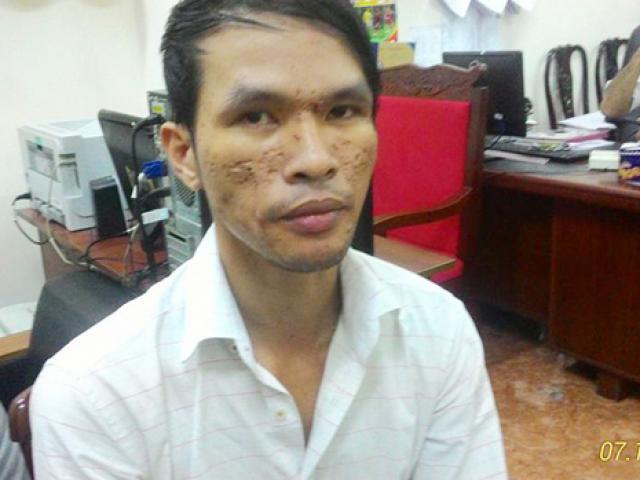 Tin tức trong ngày - Tin mới vụ hành hạ bé trai bằng roi điện: Khởi tố Dũng Cam