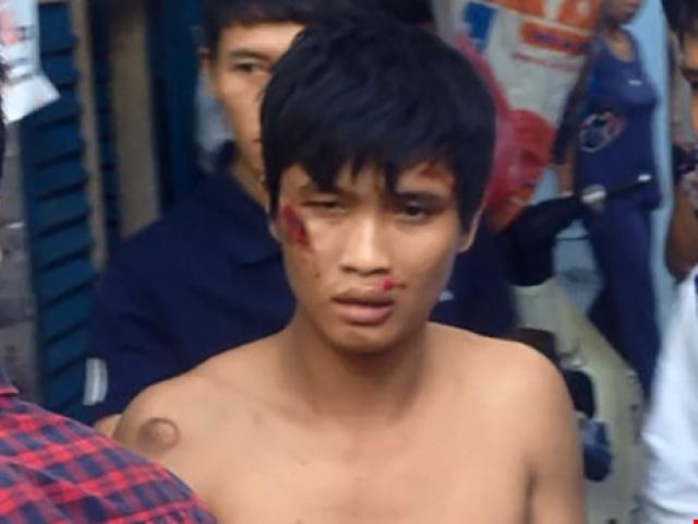 Pháp luật - Thanh niên vào nhà người lạ, lấy nước mắm đổ lên đầu